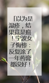 以为是湿疹，结果竟是癌！宁波女子悔惨：反复涂了一年药膏都没好！很多患者首诊都去了皮肤科